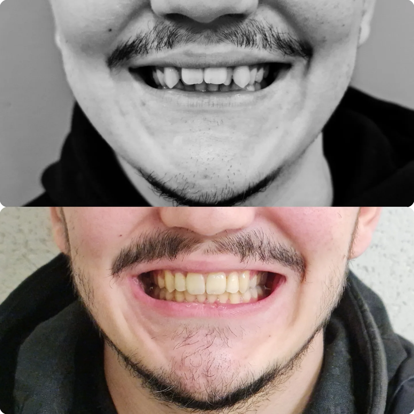 481856699_18085931449580179_2981950589162676876_n