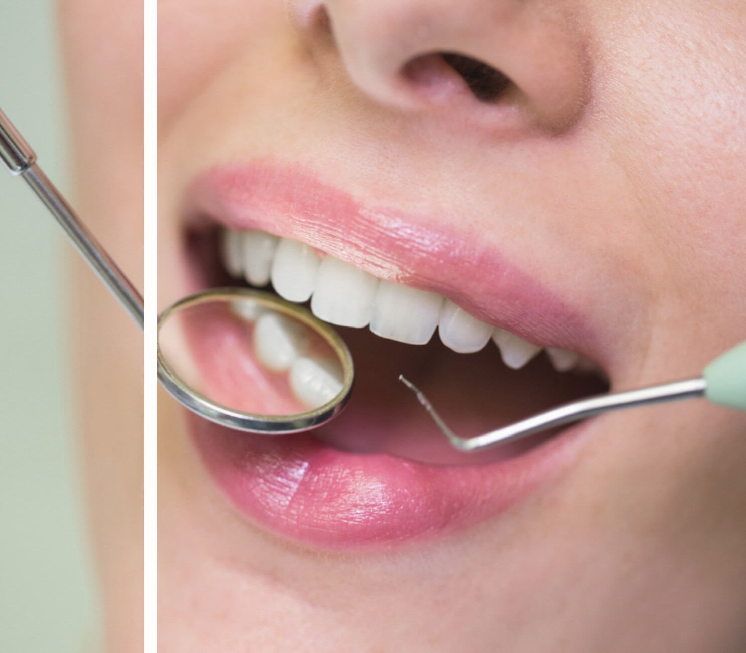 Diş Taşı Temizleme