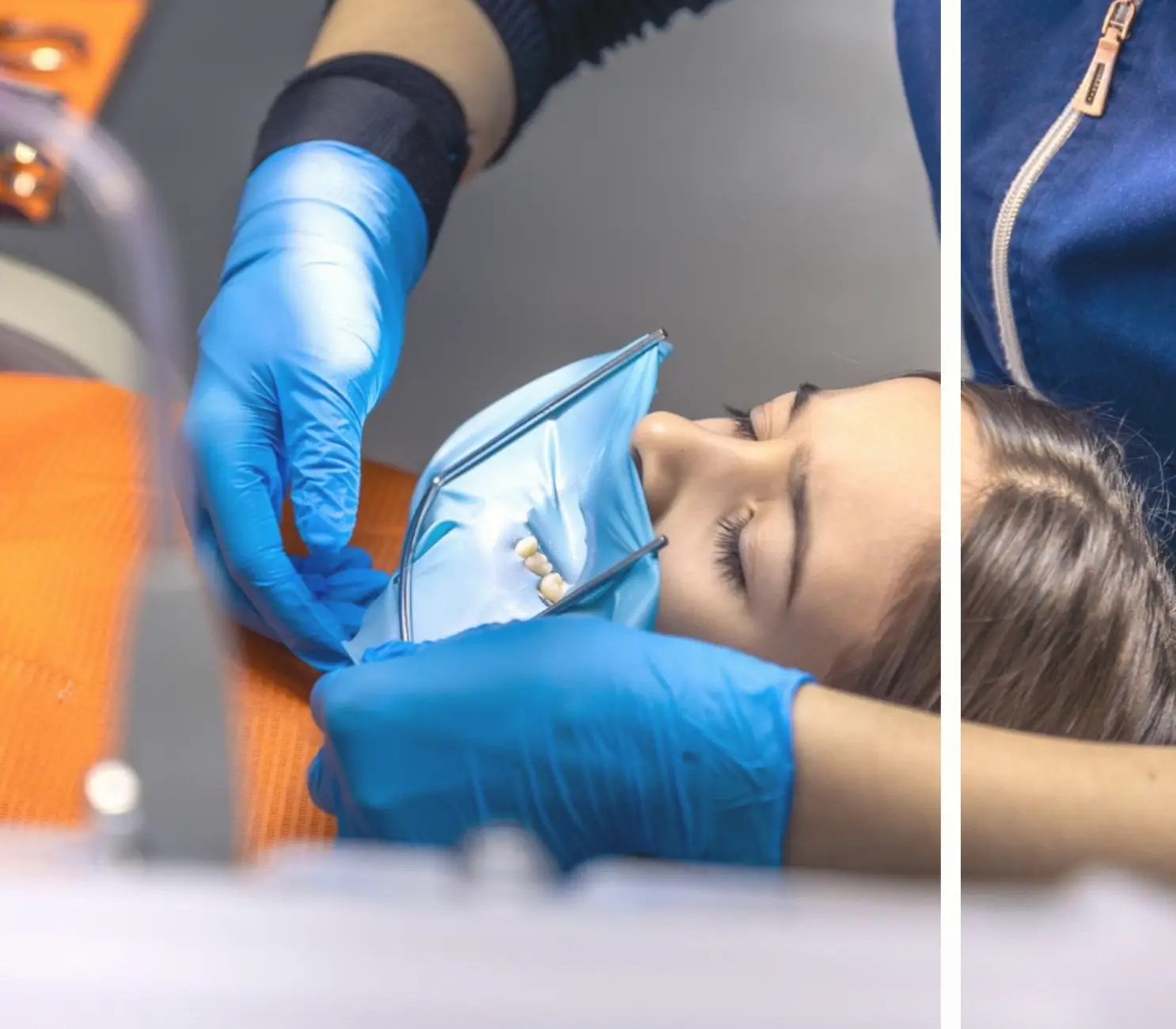 Gömülü Diş Çekimi