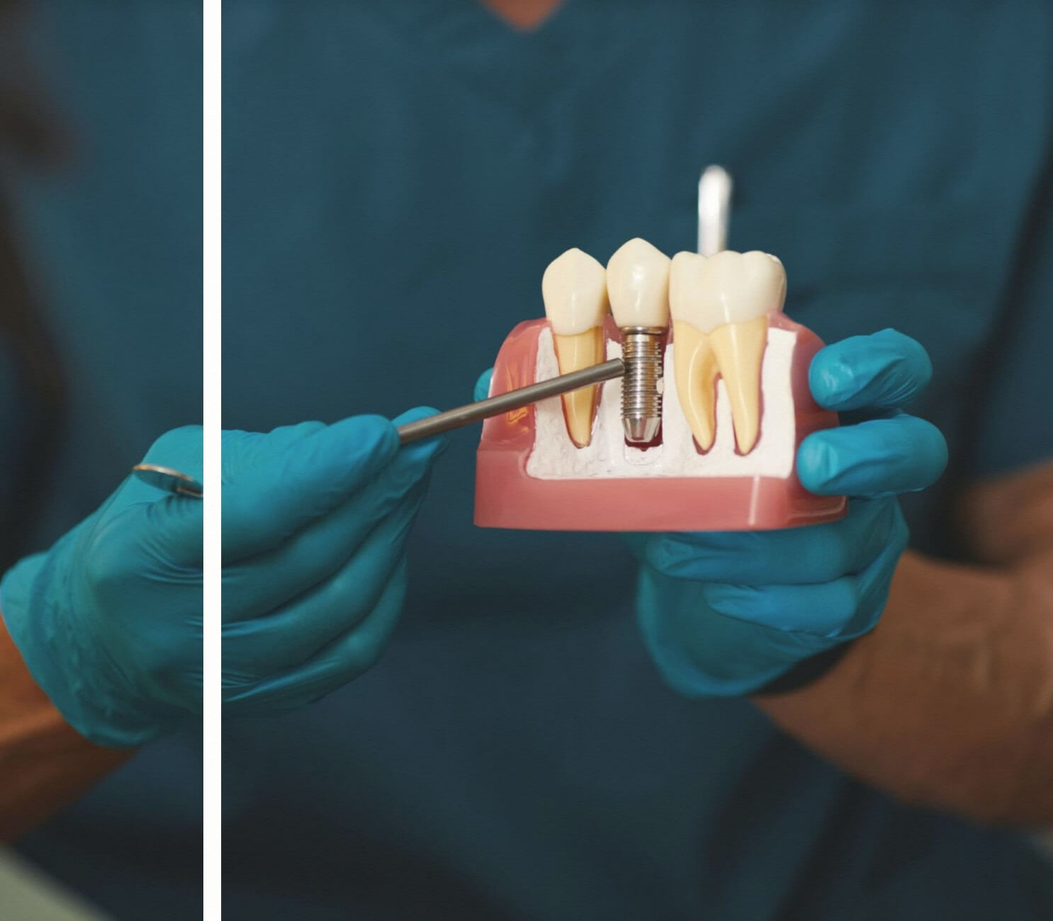 Doktor implant modeli gösteriyor.