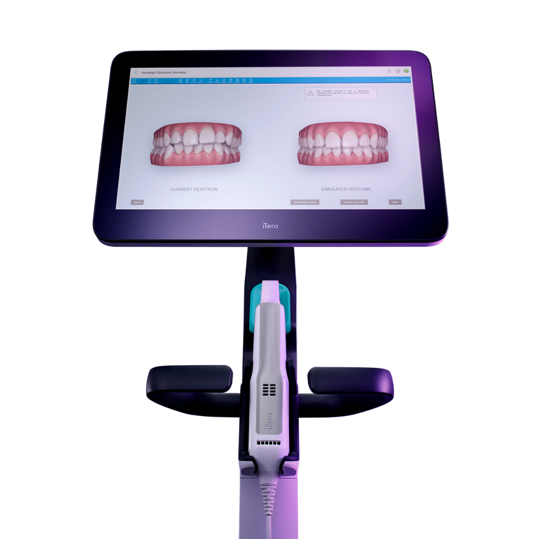 iTero dijital tarama