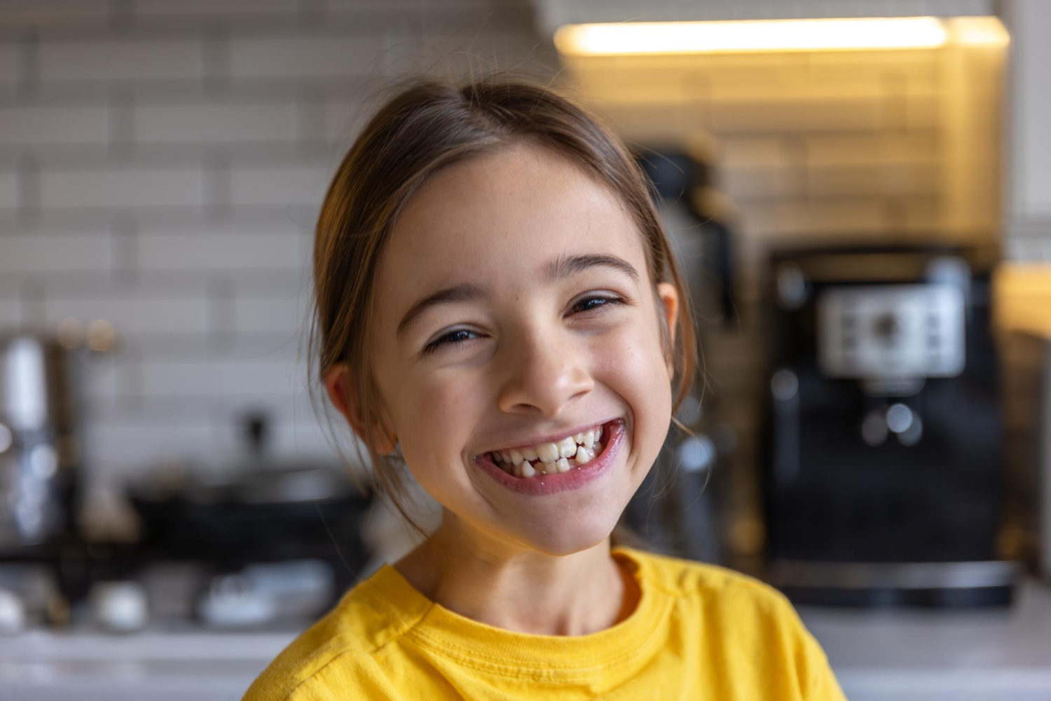 Çocuğumun Dişleri Eğri Ne Zaman Ortodontiste Götürmeliyim?