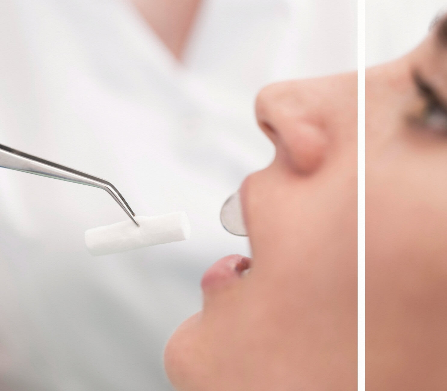 Diş Çekimi Sonrası Pamuk Koyuluyor