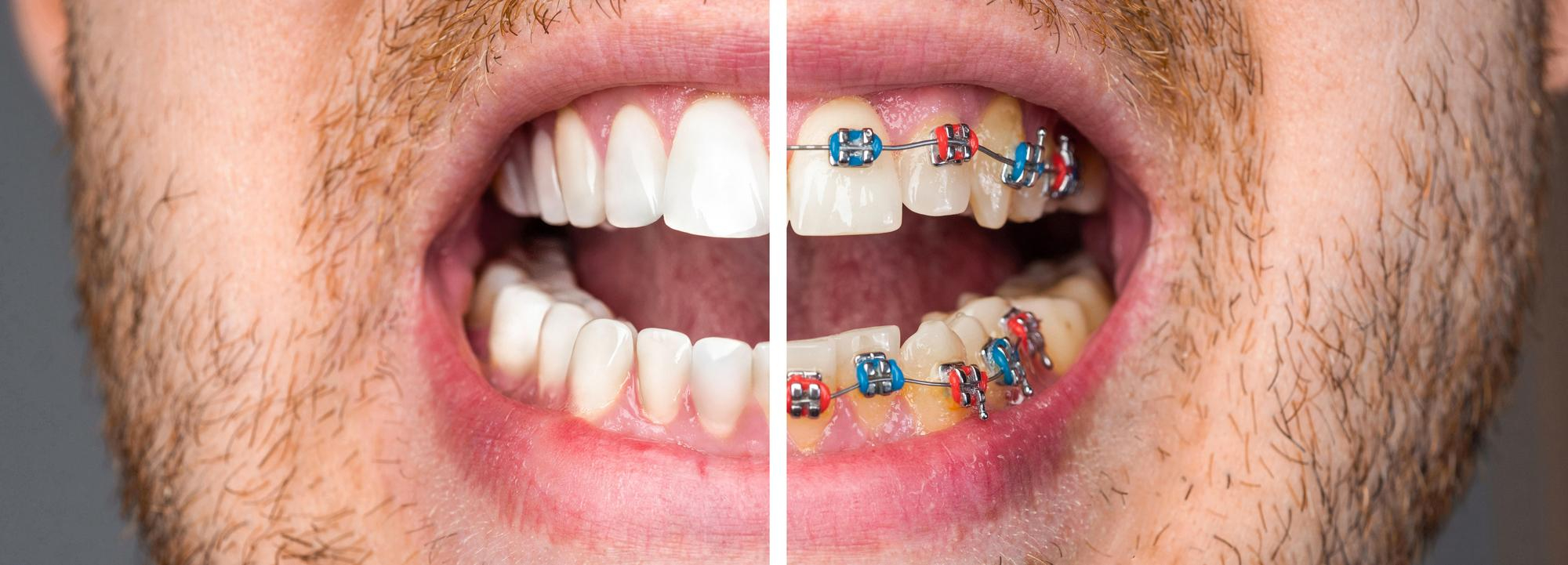 Gerçek Öncesi Sonrası Dental Fotoğraflar